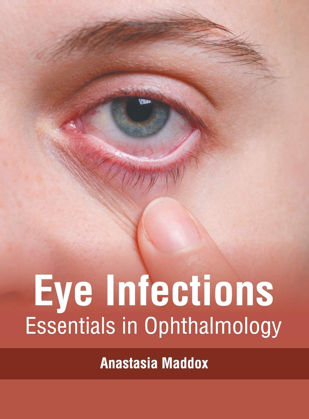 Eye Infections Medicine