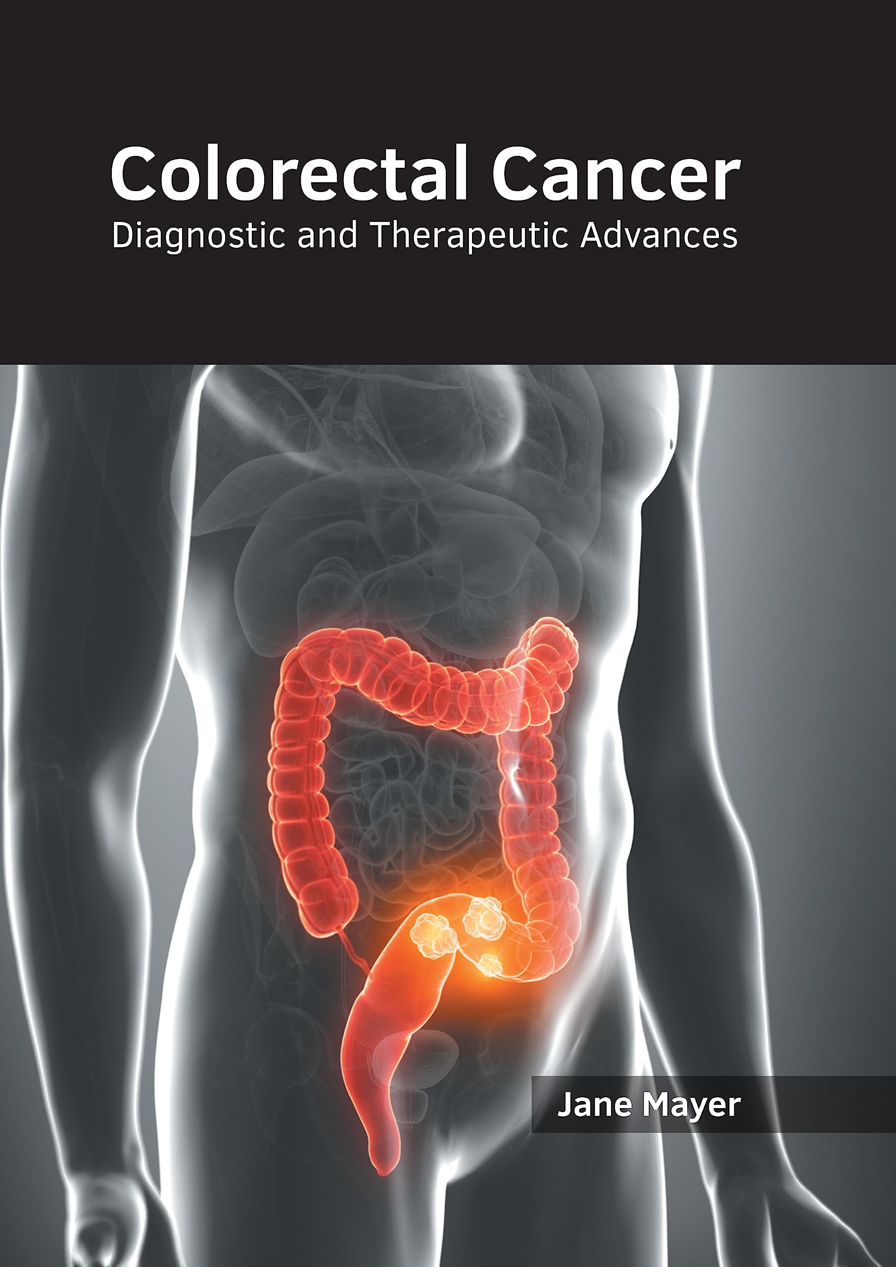 Colorectal Cancer: Diagnostic and Therapeutic Advances Medicine