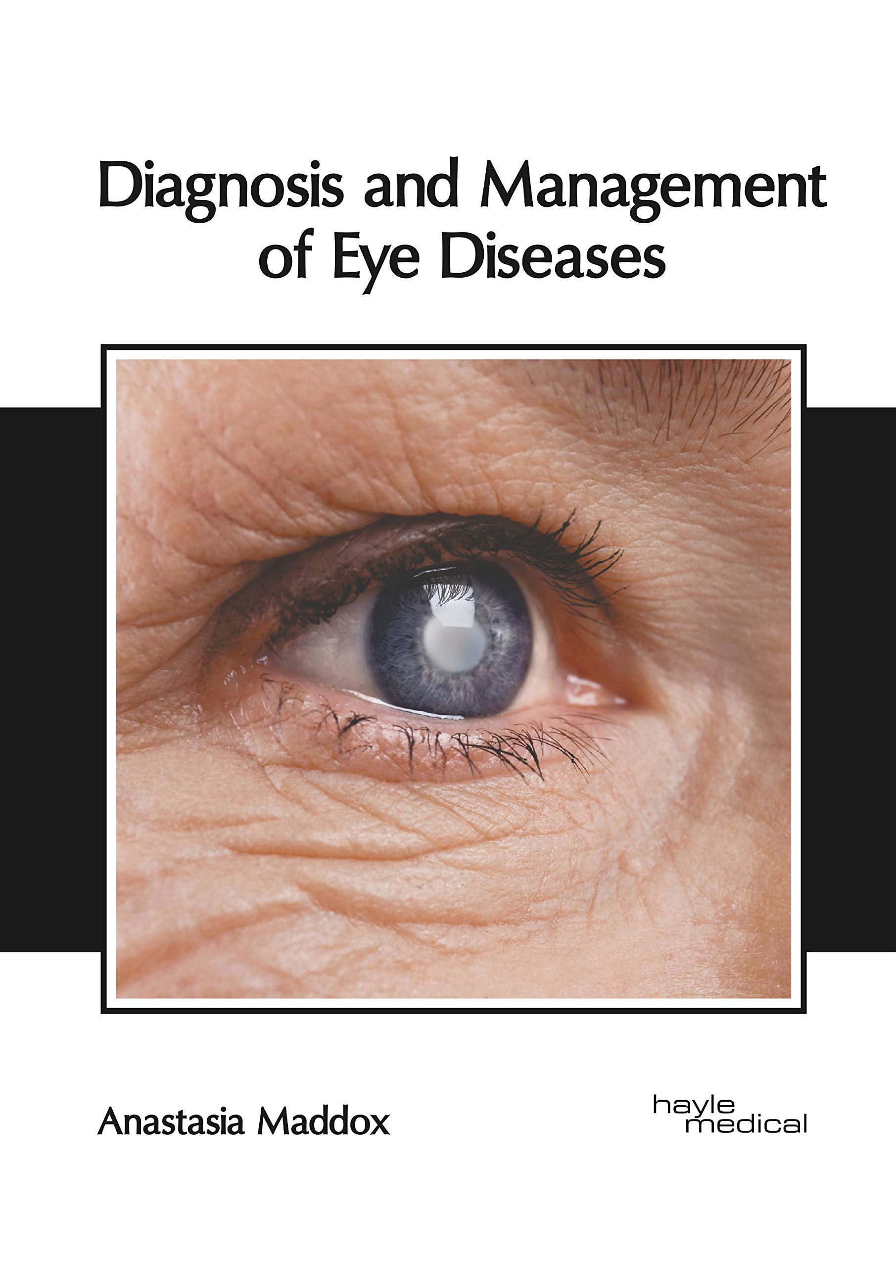 Diagnosis and Management of Eye Diseases Medicine