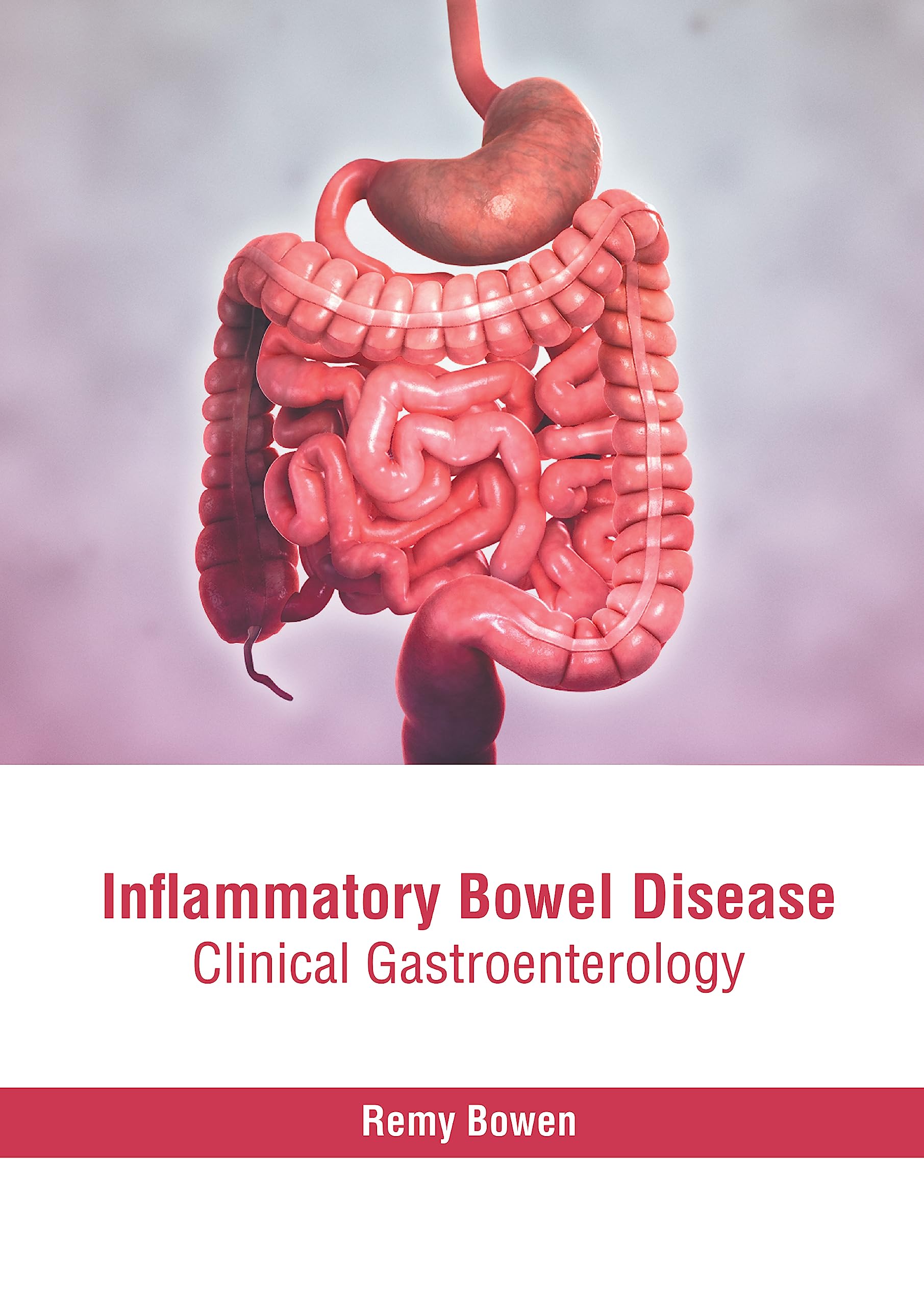 Inflammatory Bowel Disease: Clinical Gastroenterology Medicine