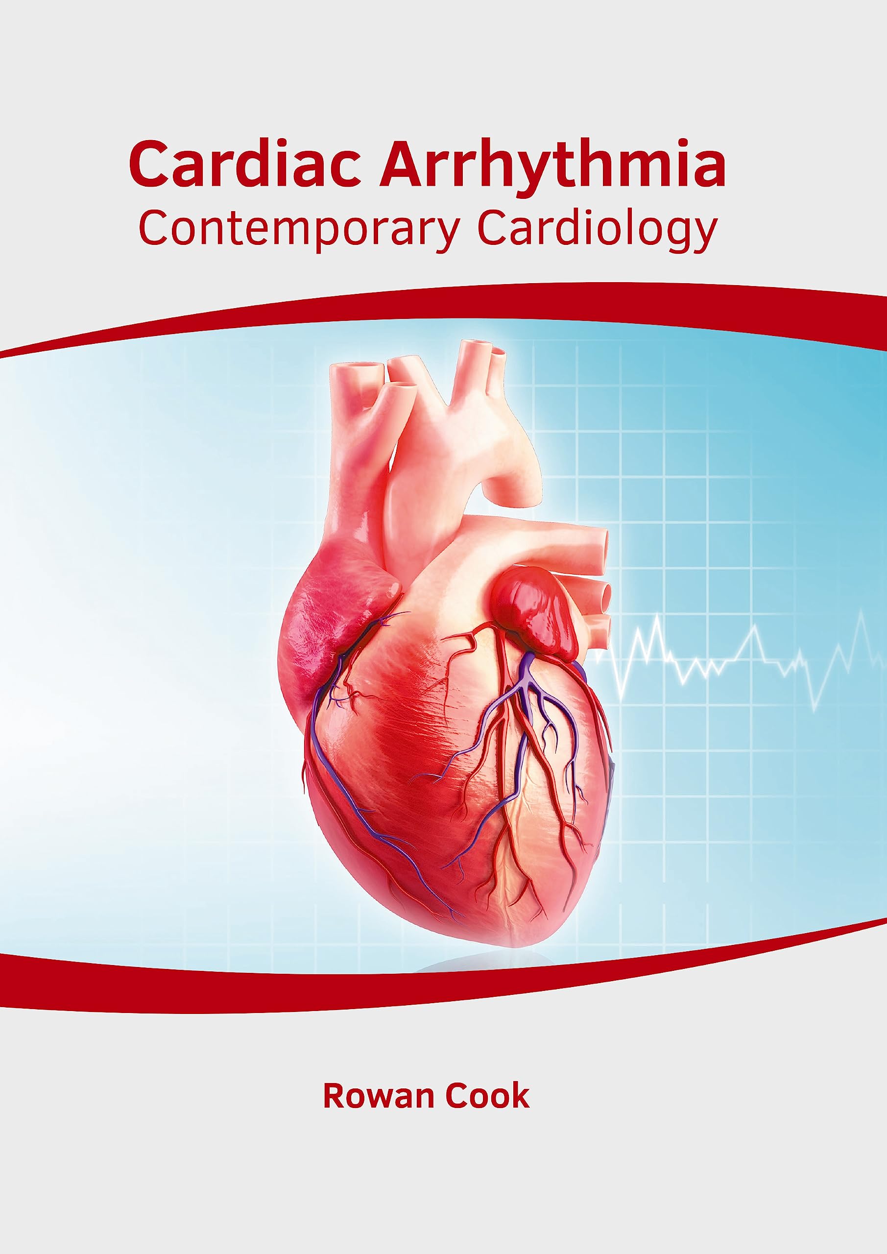Cardiac Arrhythmia: Contemporary Cardiology Medicine