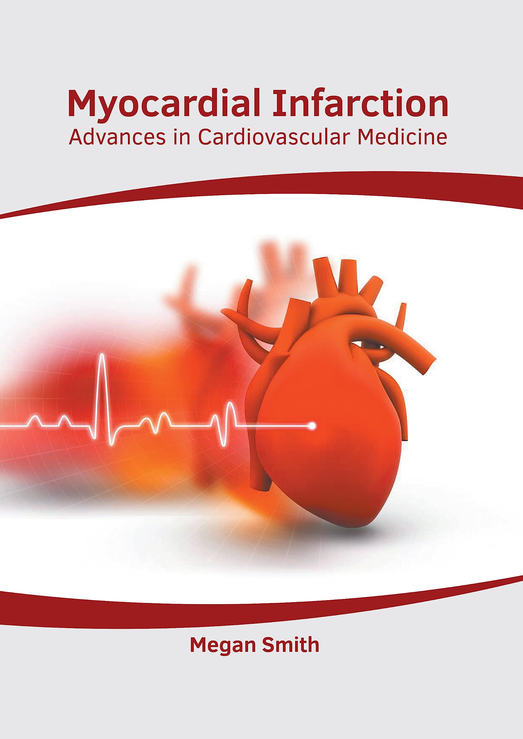 Myocardial Infarction: Advances in Cardiovascular Medicine Medicine