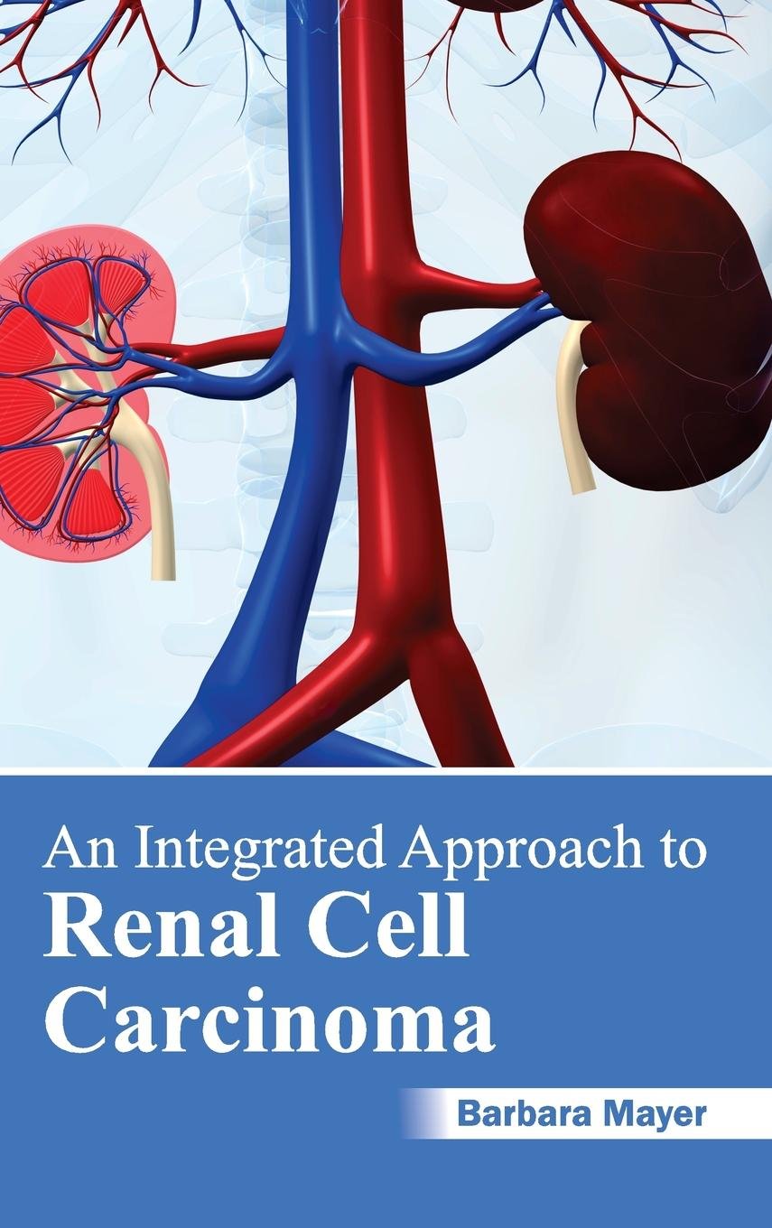 An Integrated Approach to Renal Cell Carcinoma Medicine