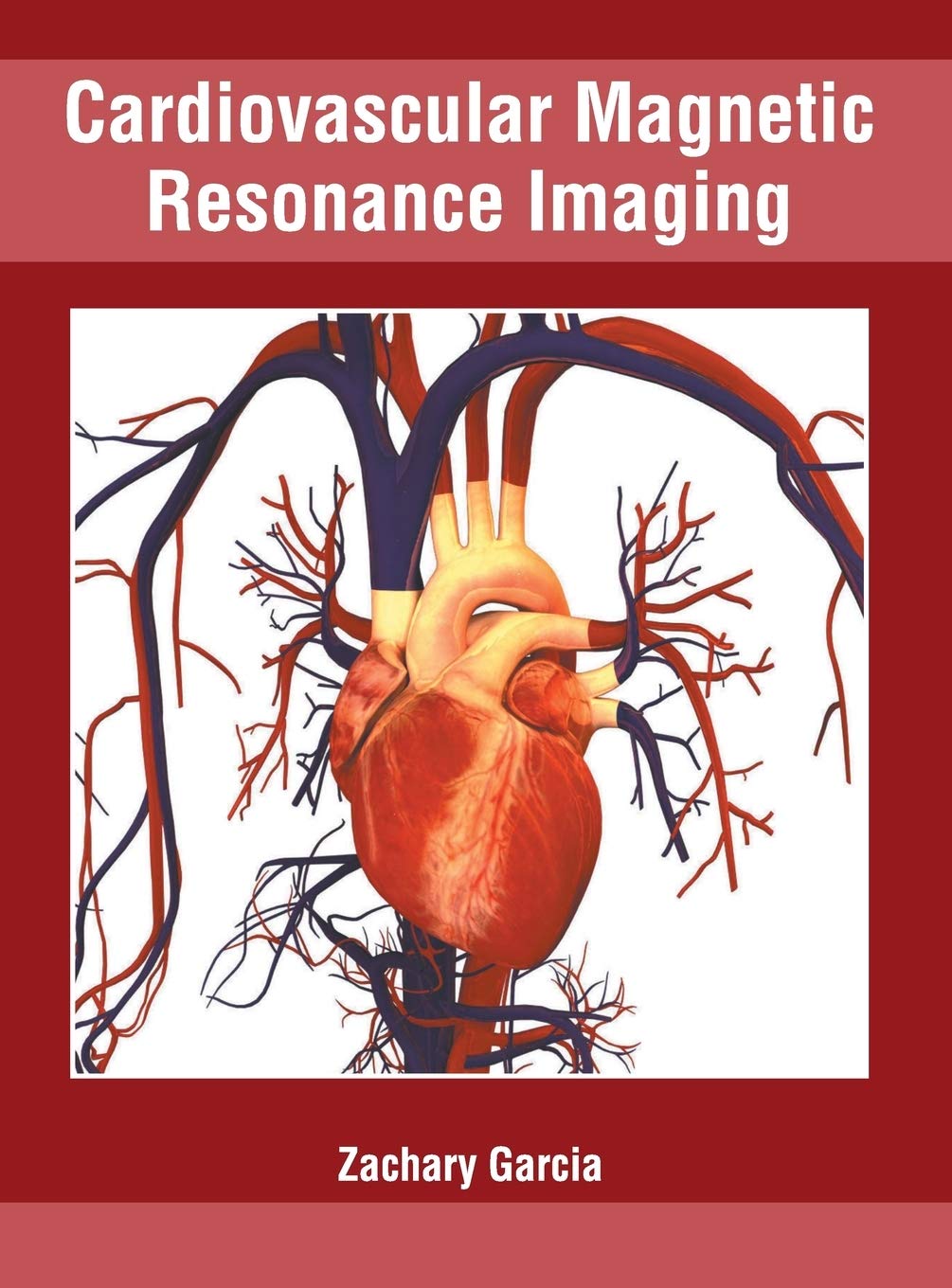 Cardiovascular Magnetic Resonance Imaging Medicine