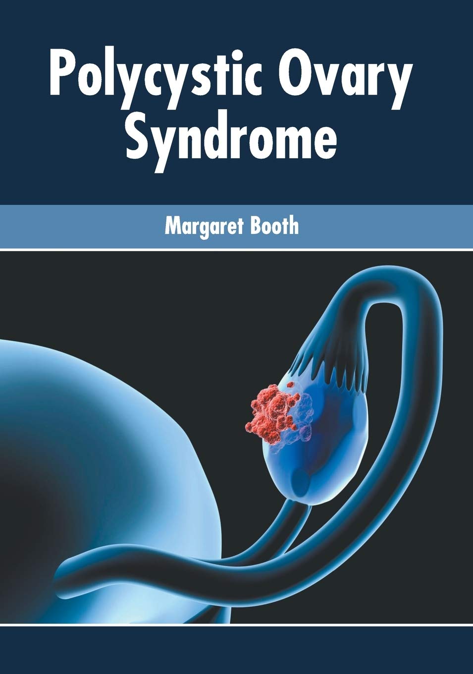 Polycystic Ovary Syndrome Medicine