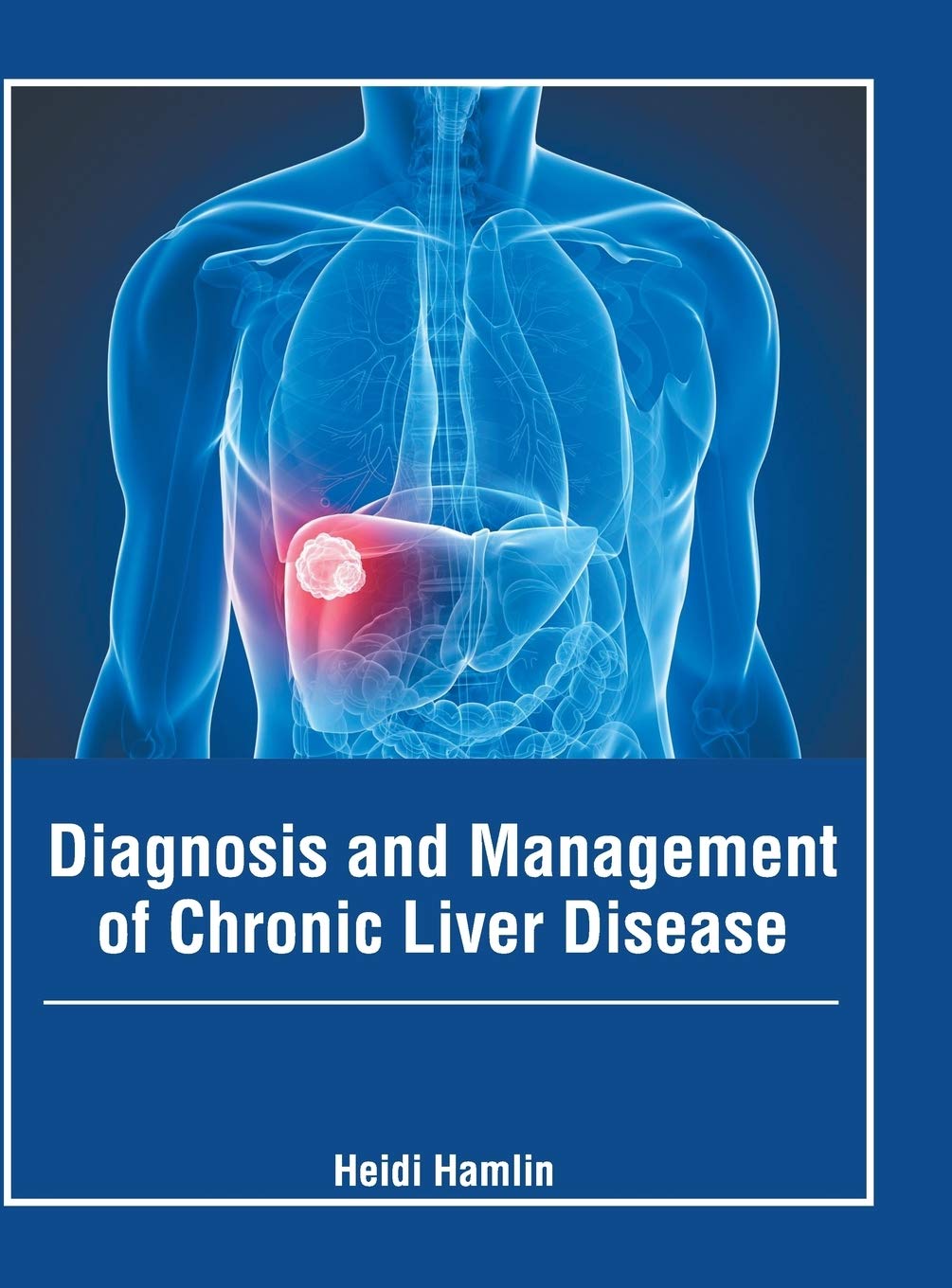 Diagnosis and Management of Chronic Liver Disease Medicine