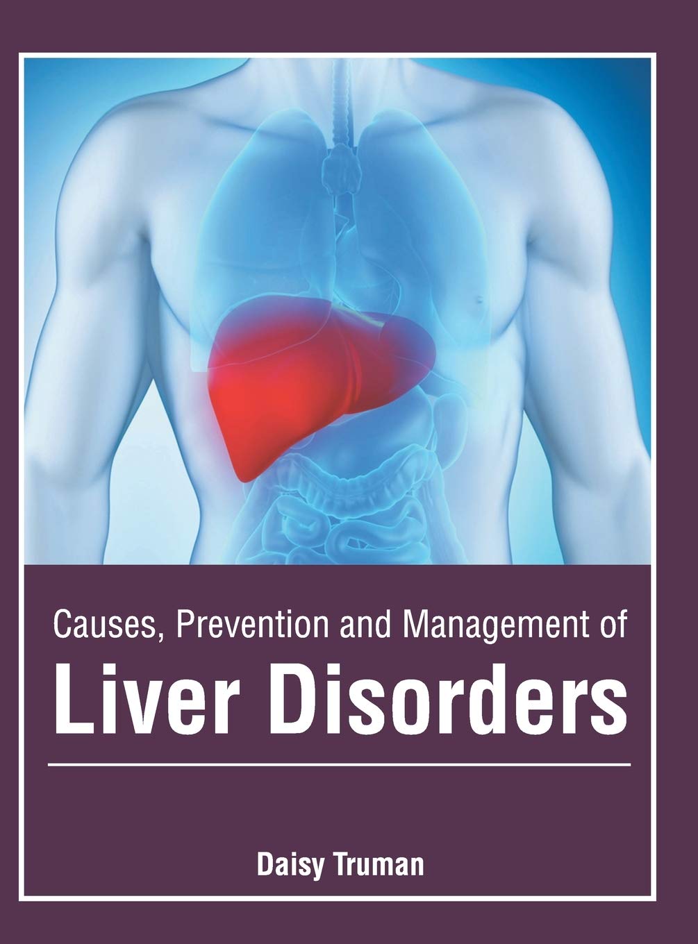 Causes, Prevention and Management of Liver Disorders Medicine