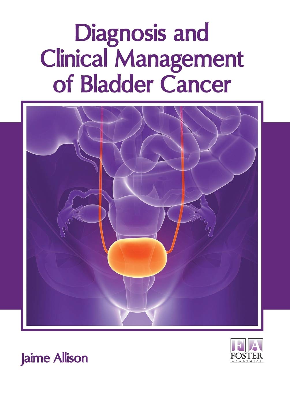 Diagnosis and Clinical Management of Bladder Cancer Medicine
