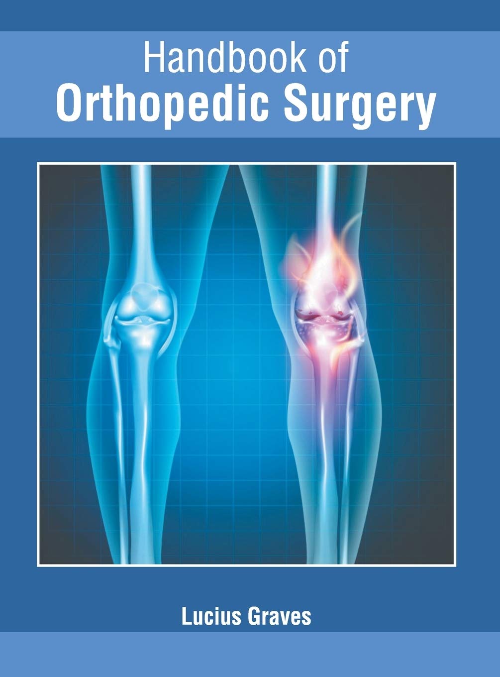 Handbook of Orthopedic Surgery Medicine