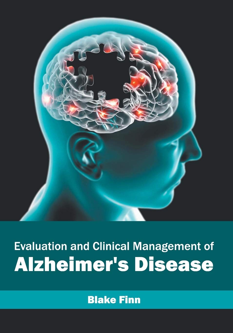 Evaluation and Clinical Management of Alzheimer's Disease Medicine