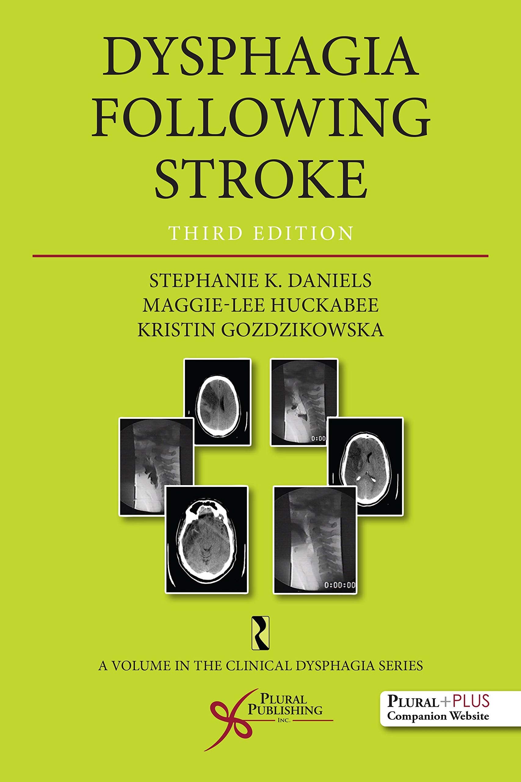 Dysphagia Following Stroke (Clinical Dysphagia) Medicine