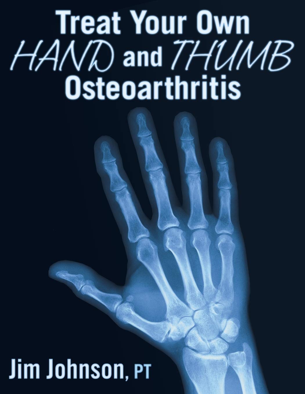 Treat Your Own Hand and Thumb Osteoarthritis Medicine