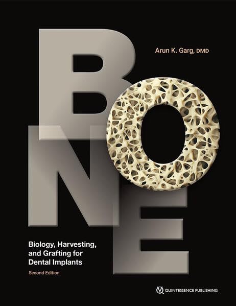 Bone: Biology, Harvesting, and Grafting for Dental Implants Medicine