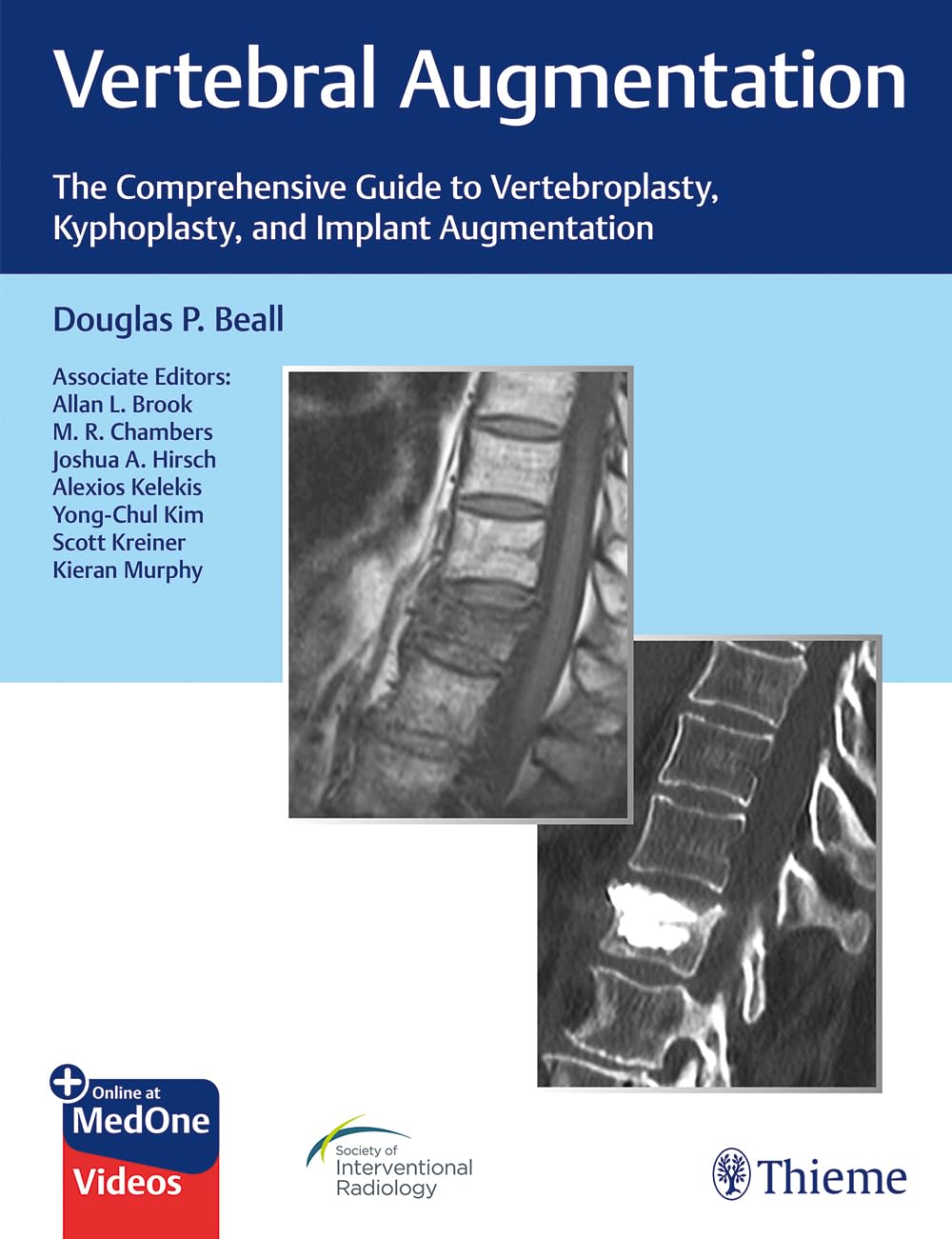 Vertebral Augmentation: The Comprehensive Guide to Vertebroplasty, Kyphoplasty, and Implant Augmentation book