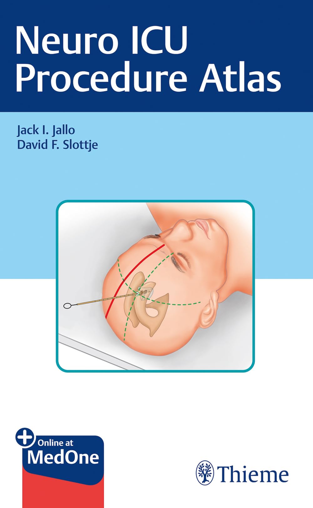 Neuro ICU Procedure Atlas: Including online access Medicine