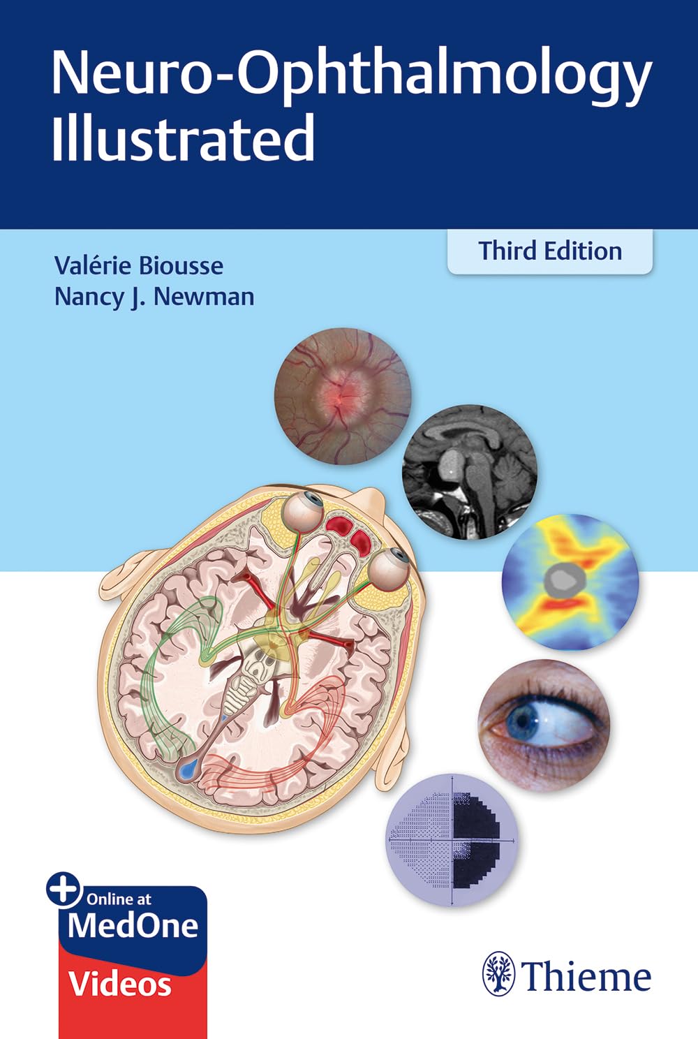 Neuro-Ophthalmology Illustrated: Mit Online-Zugang Medicine