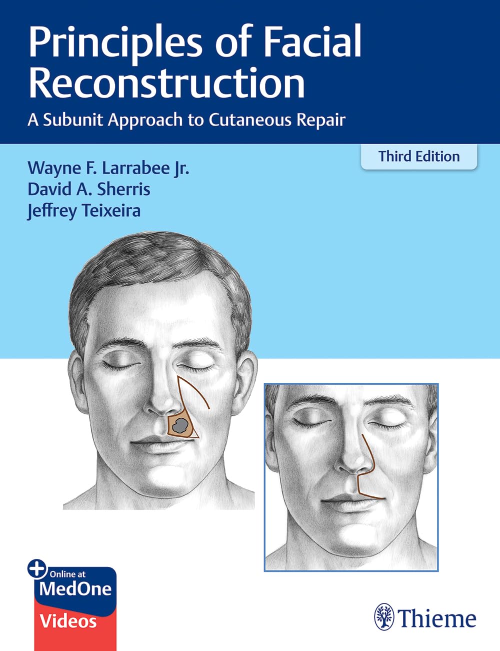 Principles of Facial Reconstruction: A Subunit Approach to Cutaneous Repair Medicine