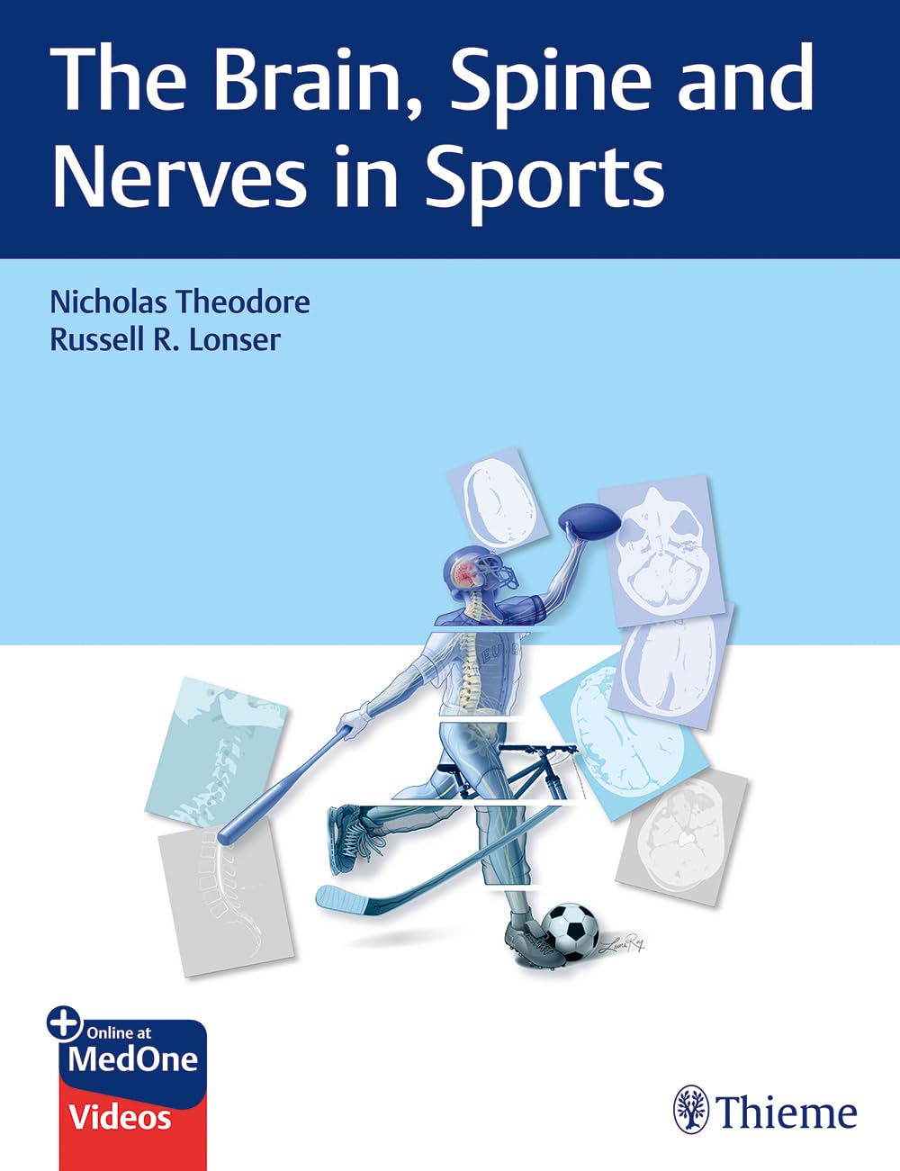 The Brain, Spine and Nerves in Sports Medicine