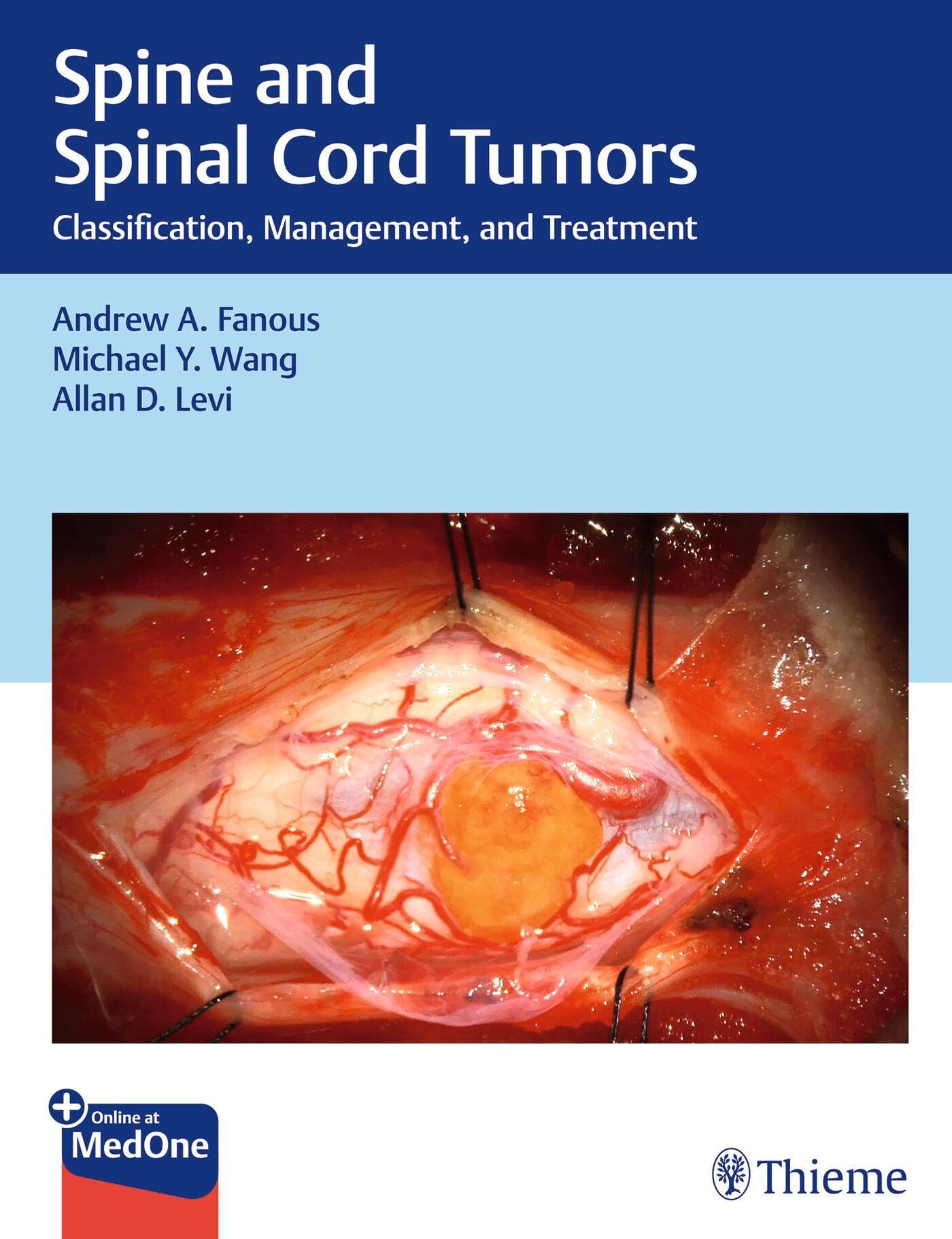 Spine and Spinal Cord Tumors Medicine