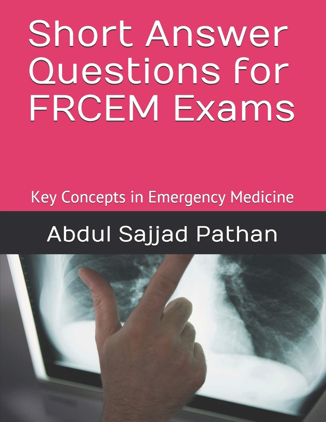 Short Answer Questions for FRCEM Exams: Key Concepts in Emergency Medicine Study Guides
