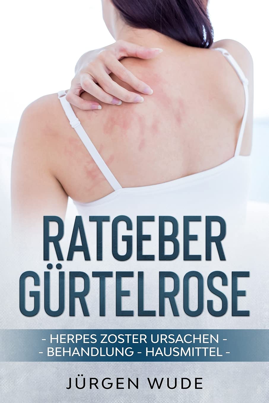 Ratgeber Gürtelrose: Herpes Zoster Ursachen Behandlung Hausmittel Medicine