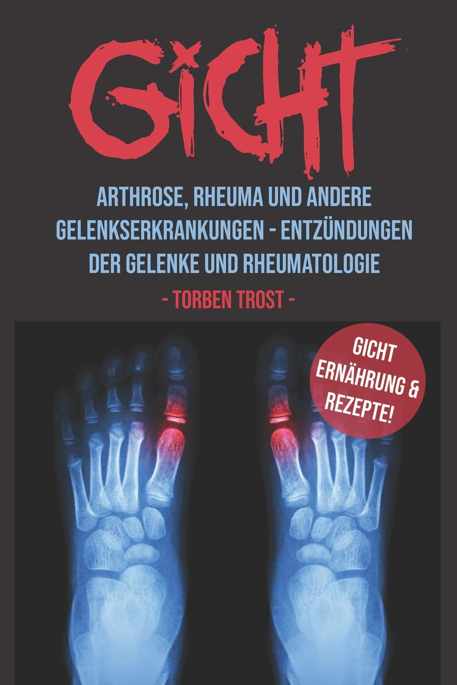 Gicht Arthrose, Rheuma, und andere Gelenkserkrankungen – Entzündungen der Gelenke und Rheumatologie Gicht Ernährung und Rezepte Leisure, Home & Garden