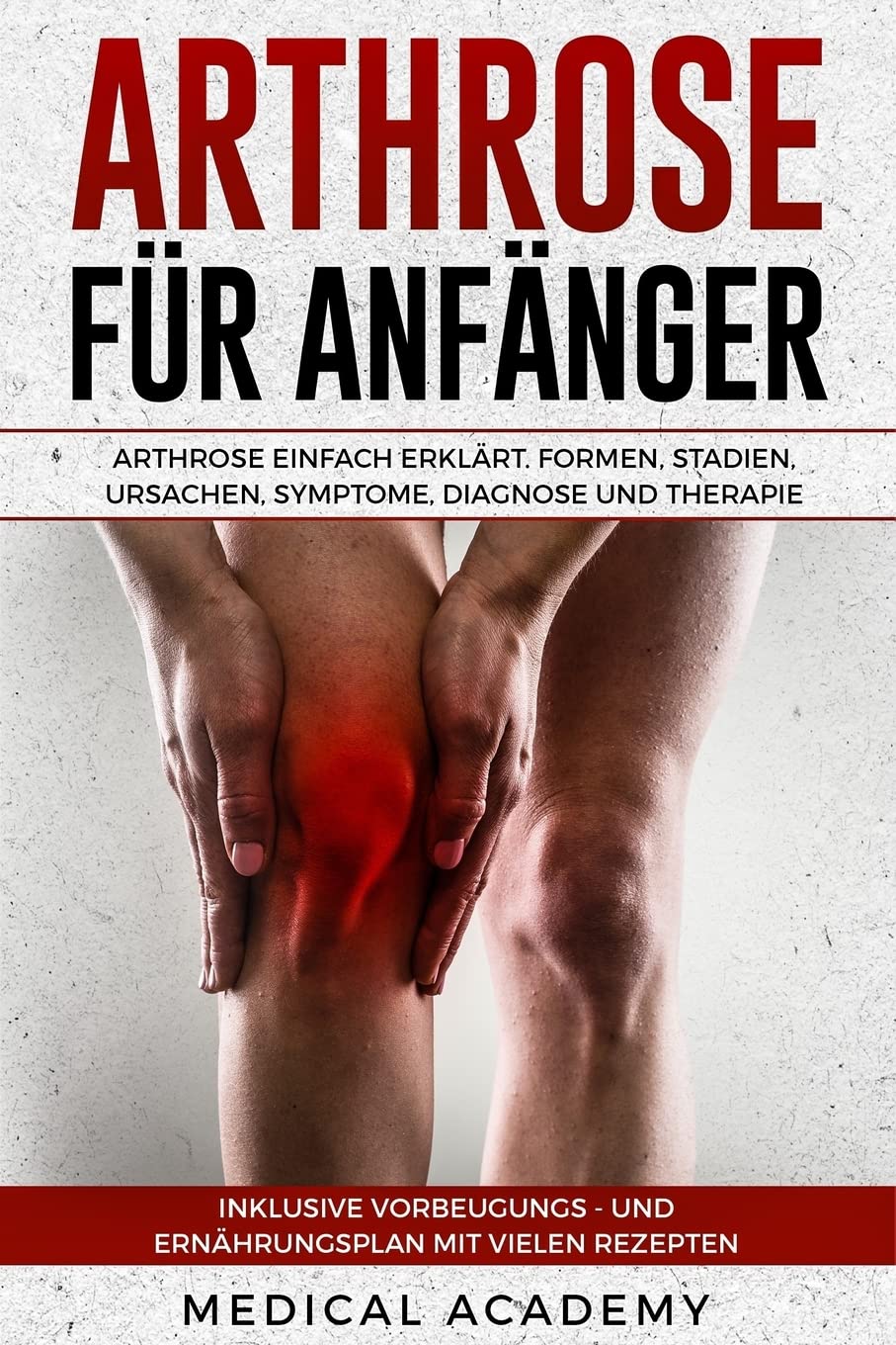 Arthrose für Anfänger: Arthrose einfach erklärt. Formen, Stadien, Ursachen, Symptome, Diagnose und Therapie. Inklusive Vorbeugungs- und Ernährungsplan mit vielen Rezepten. Business, Finance & Career