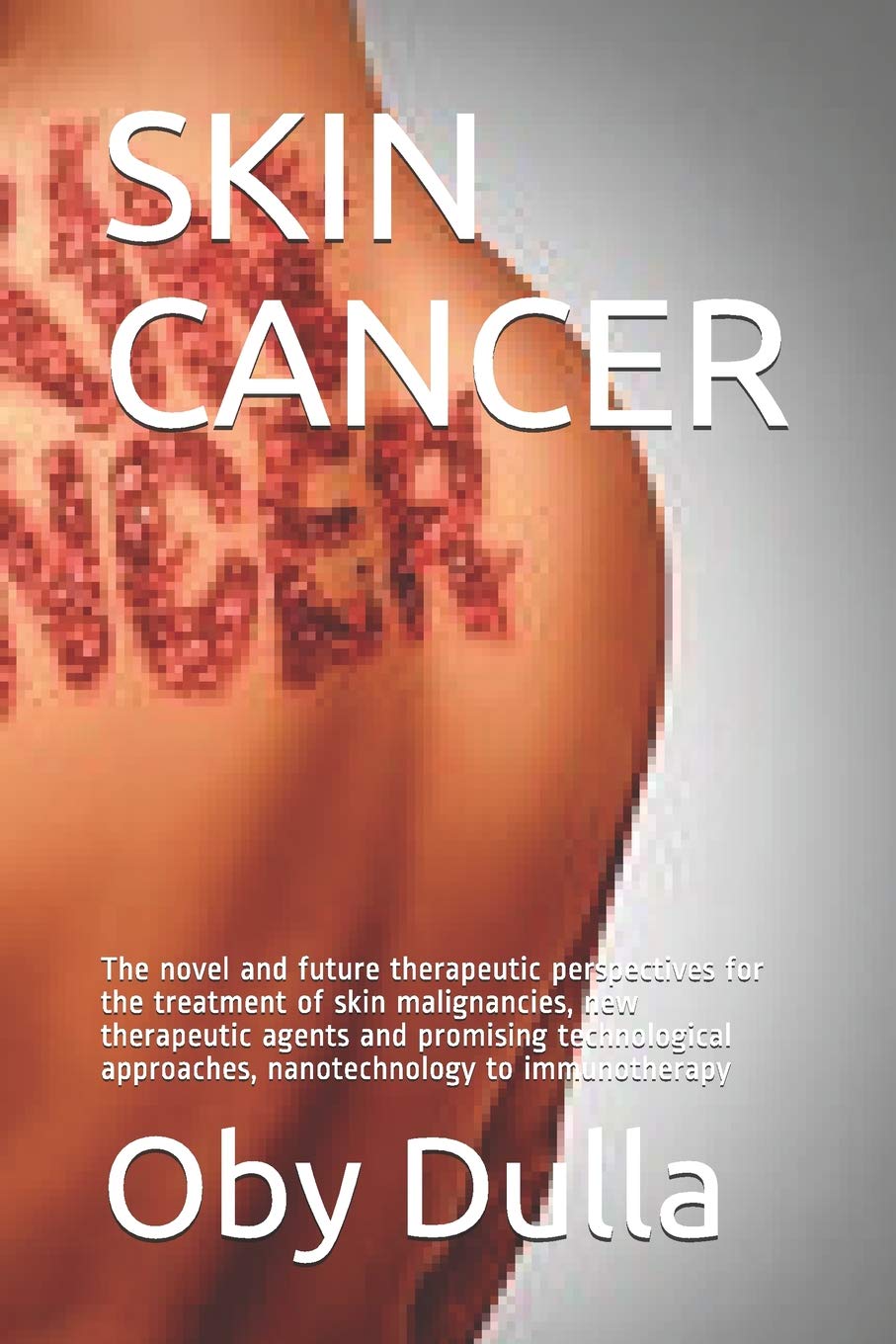SKIN CANCER: The novel and future therapeutic perspectives for the treatment of skin malignancies, new therapeutic agents and promising technological approaches, nanotechnology to immunotherapy Learning & Reference