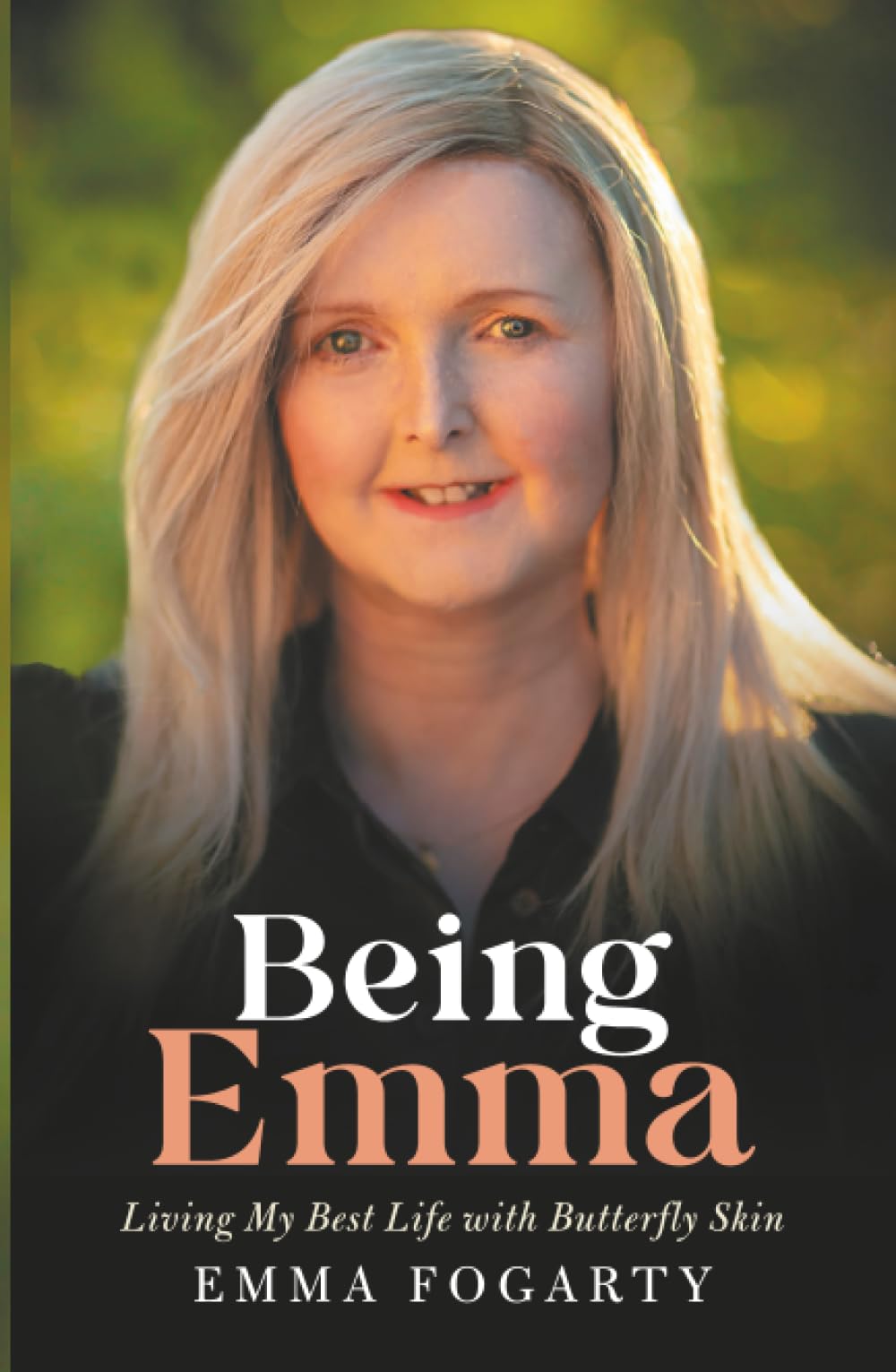 Being Emma: Living My Best Life with Butterfly Skin book