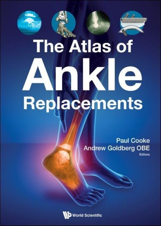 The Atlas of Ankle Replacements Medicine