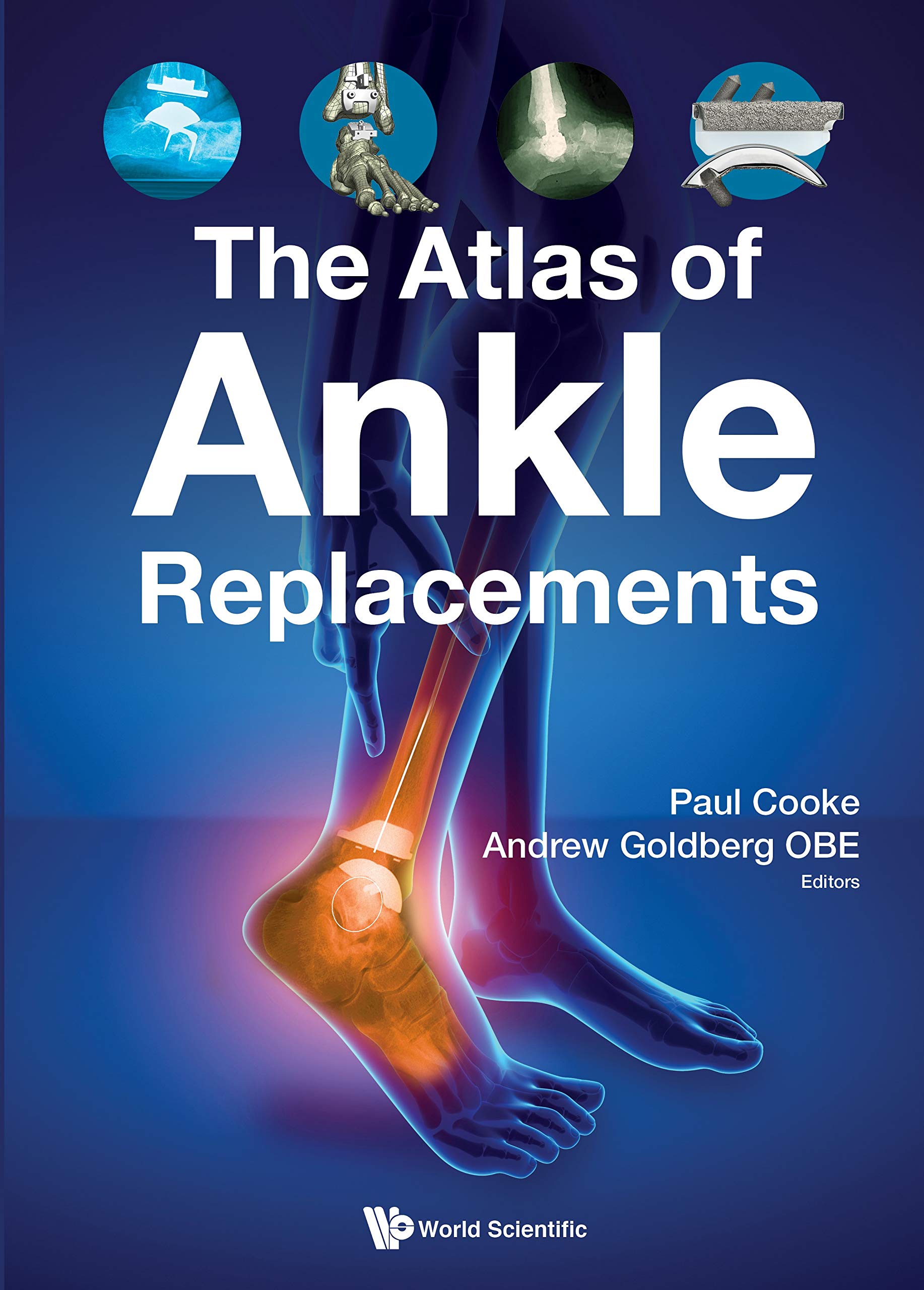 The Atlas of Ankle Replacements Medicine