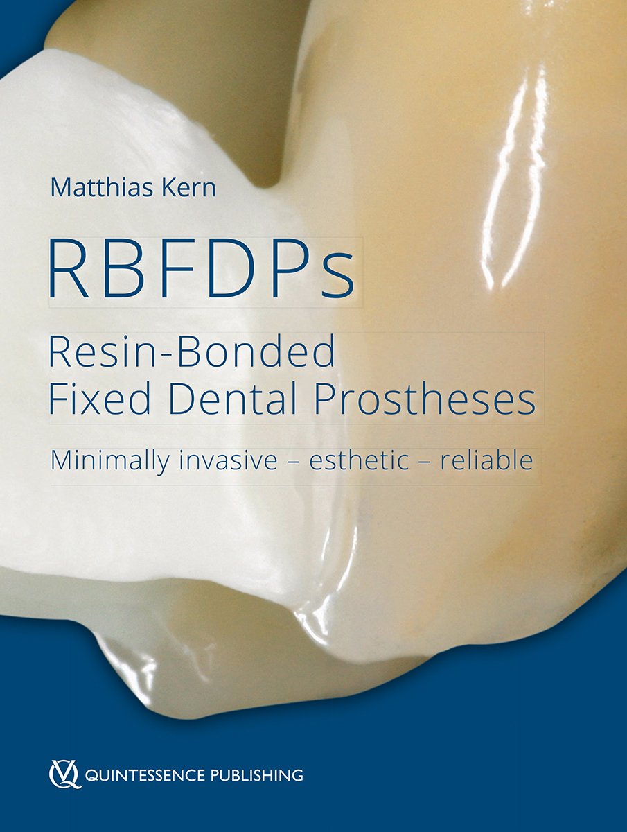 RBFDPs - Resin-Bonded Fixed Dental Prostheses: Minimally invasive - esthetic - reliable Medicine