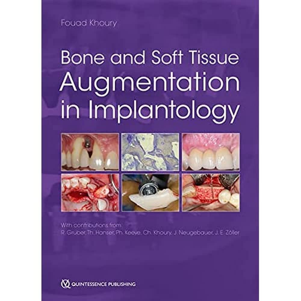 Product Image: Bone and Soft Tissue Augmentation in Implantology