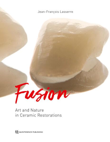 Fusion: Art and Nature in Ceramic Restorations Medicine