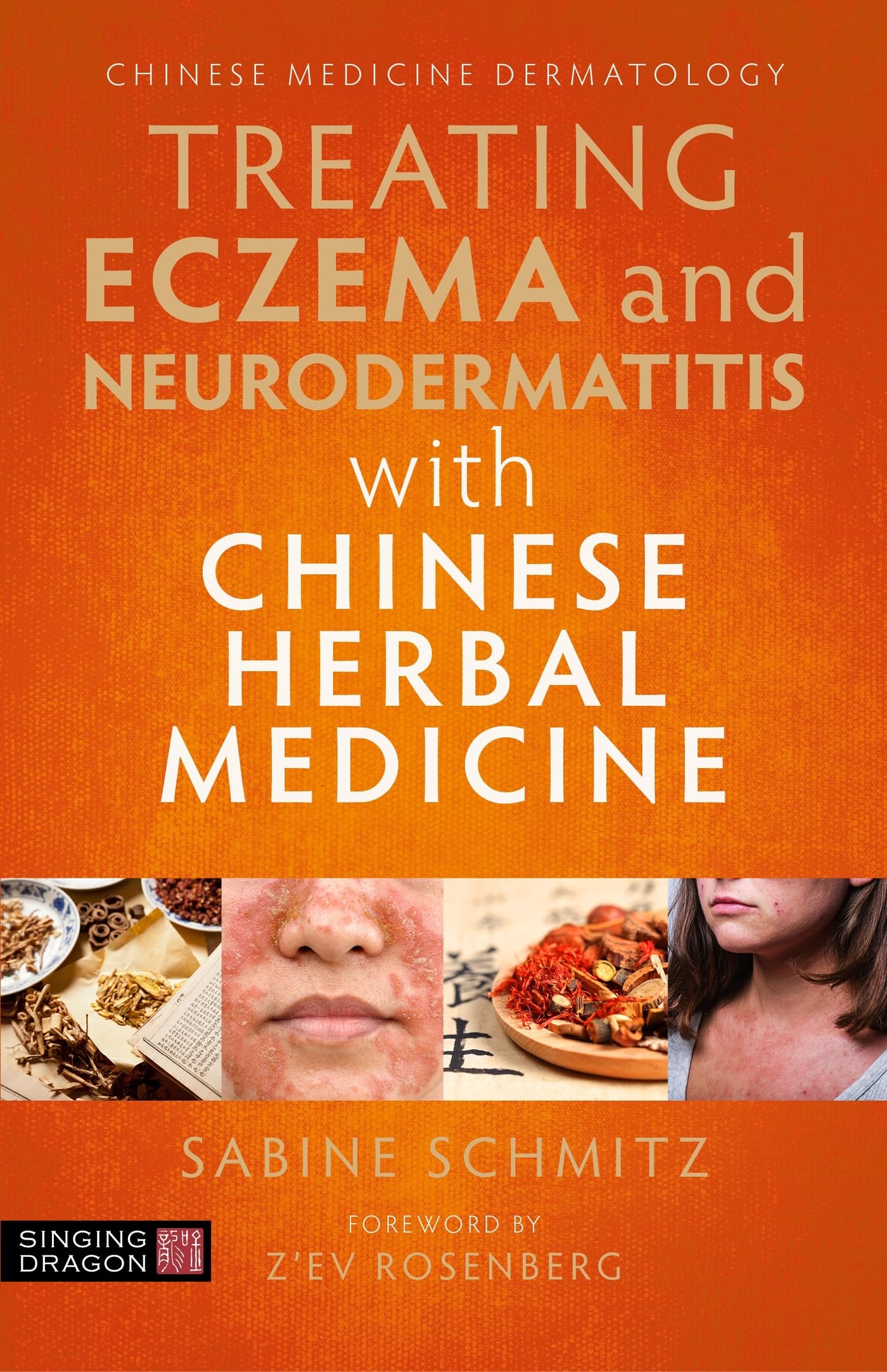 Treating Eczema and Neurodermatitis With Chinese Herbal Medicine: A Practical Handbook Medicine