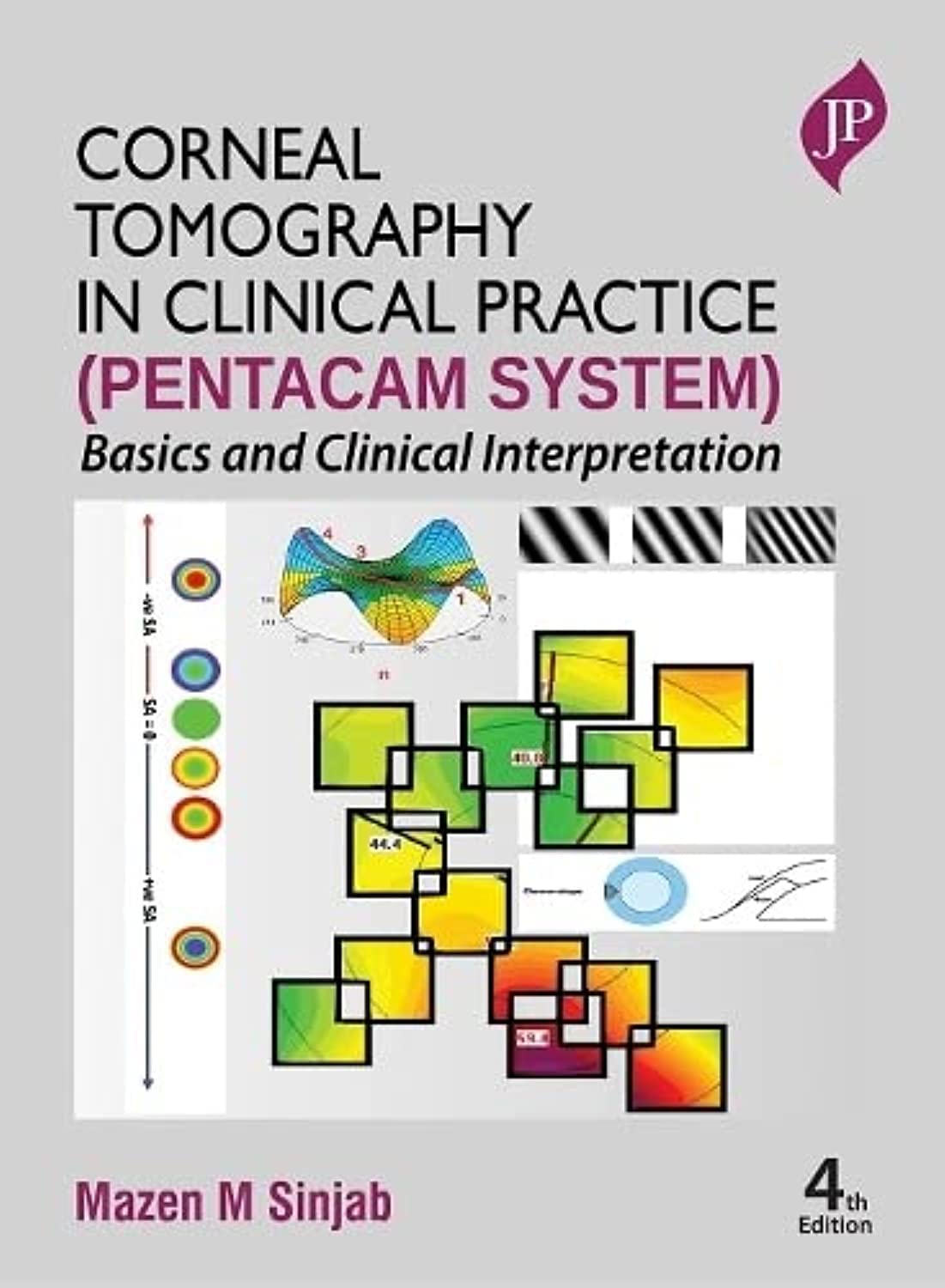 Corneal Tomography in Clinical Practice Pentacam System: Basics and Clinical Interpretation Medicine