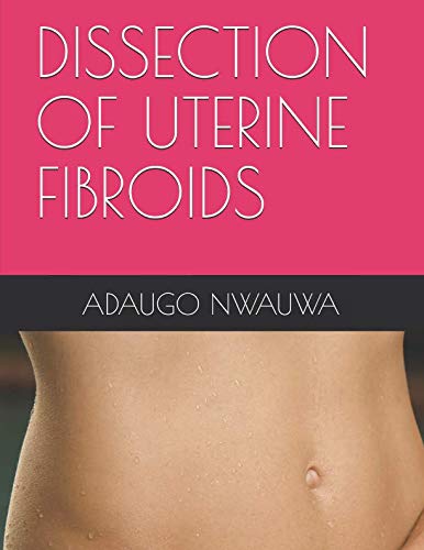 DISSECTION OF UTERINE FIBROIDS Study Guides