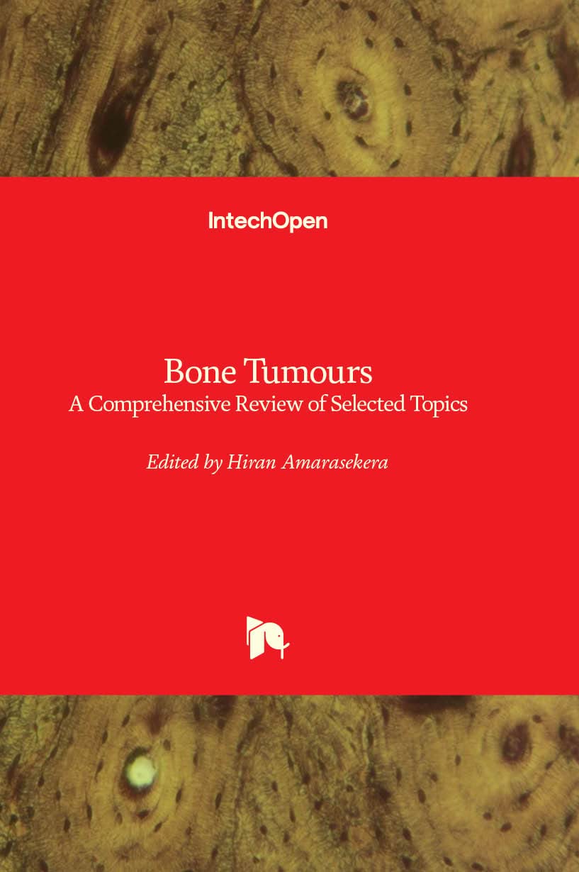 Bone Tumours - A Comprehensive Review of Selected Topics Medicine