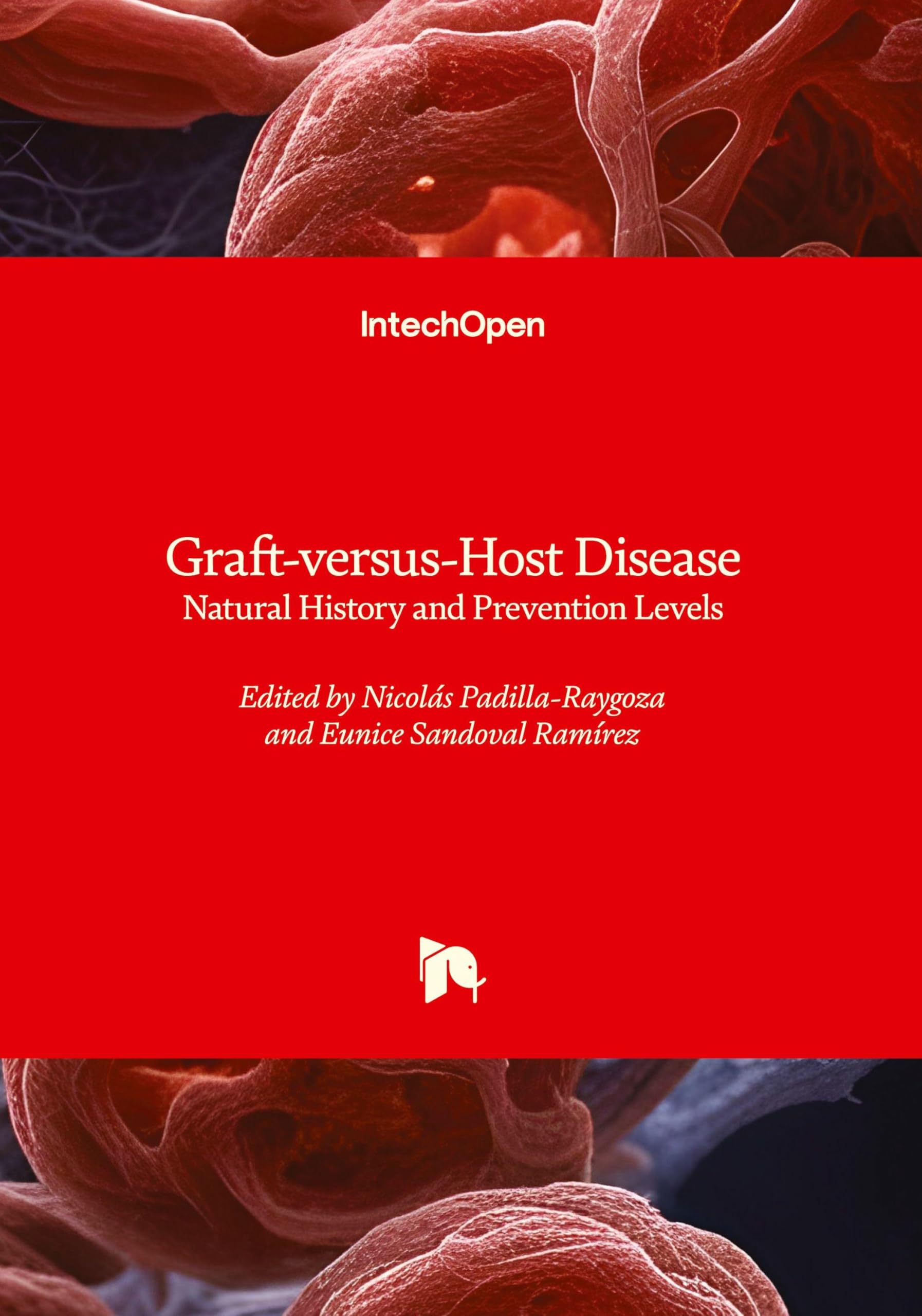 Graft-versus-Host Disease - Natural History and Prevention Levels Medicine