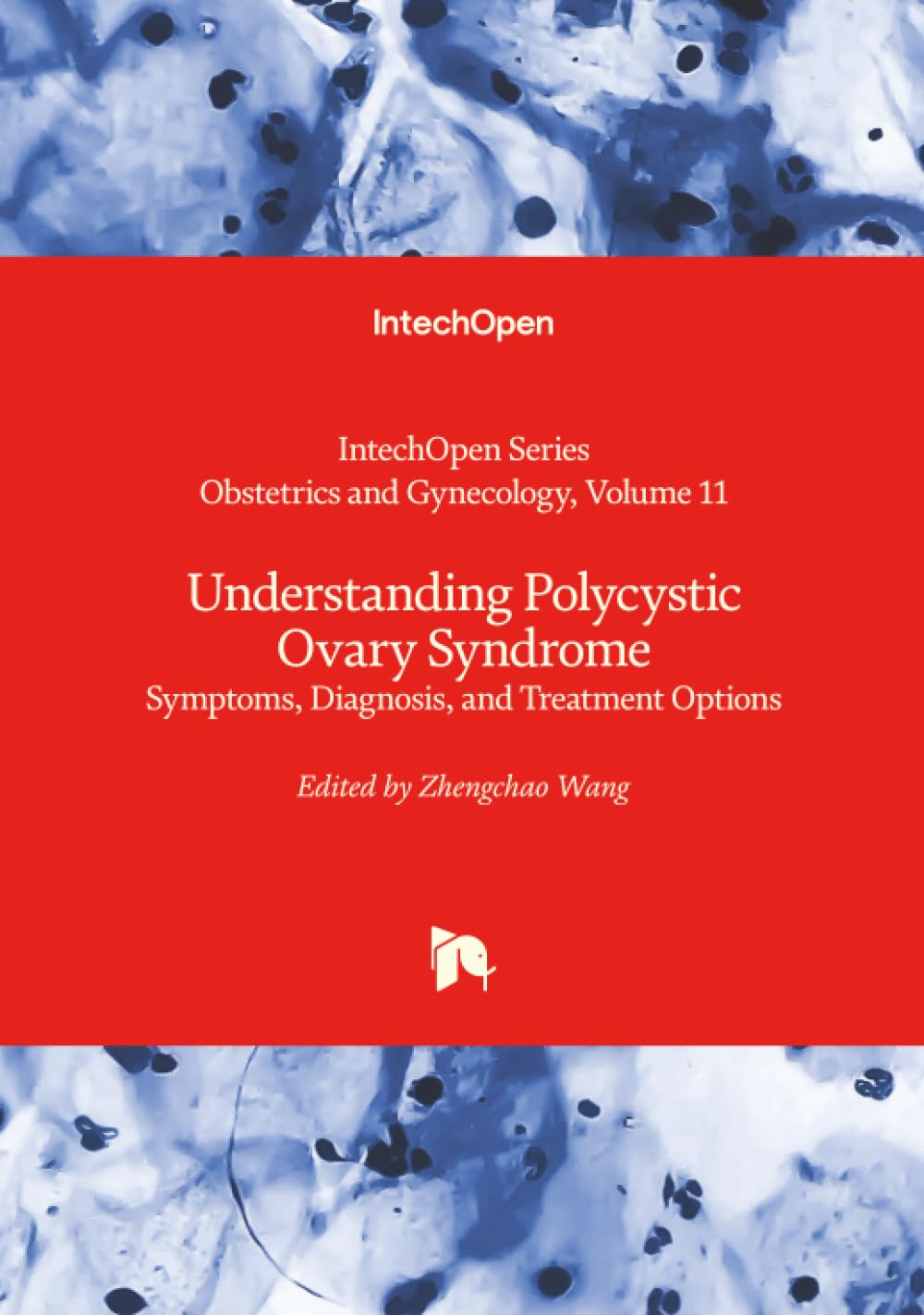 Understanding Polycystic Ovary Syndrome - Symptoms, Diagnosis, and Treatment Options Medicine
