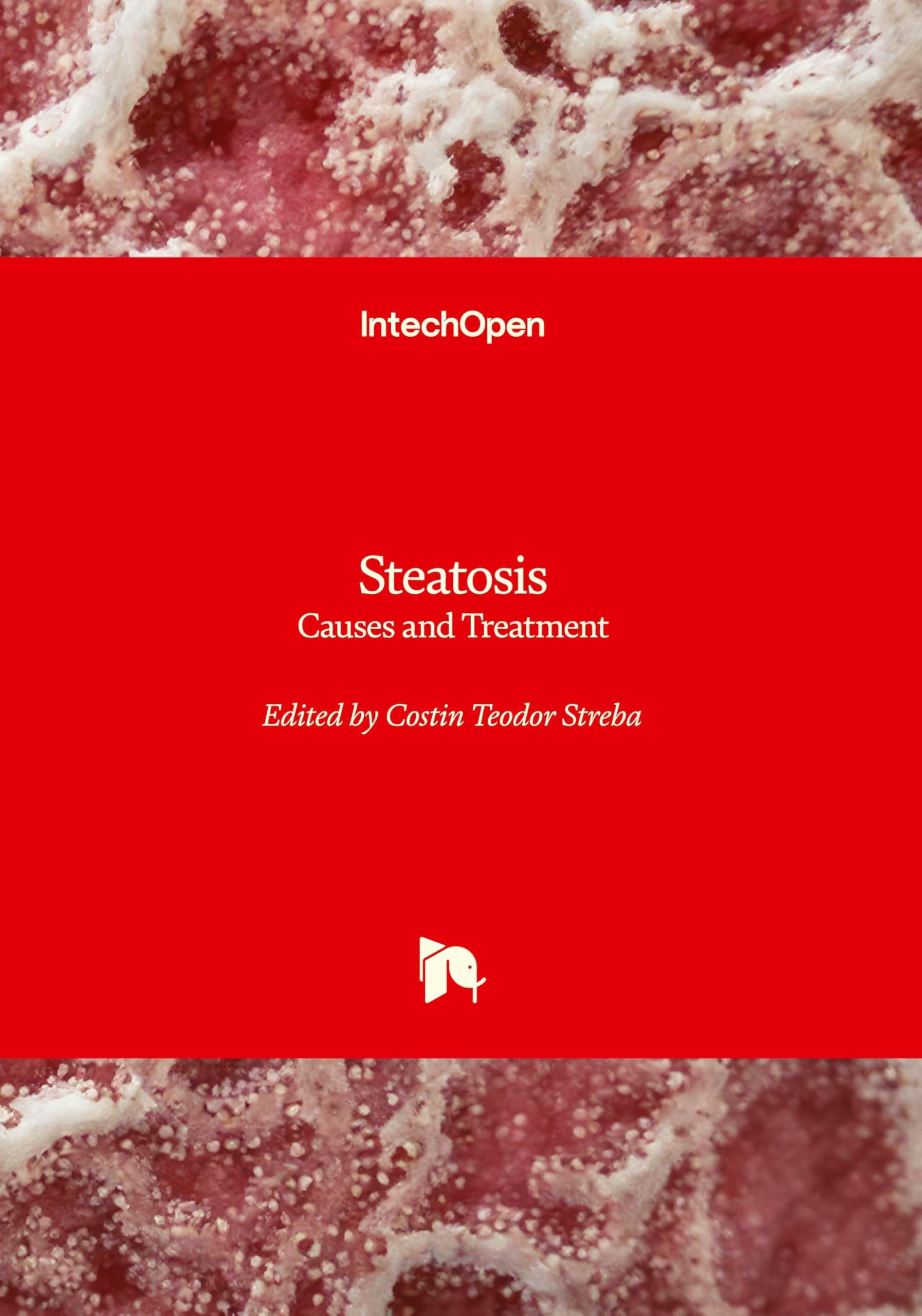 Steatosis - Causes and Treatment Medicine