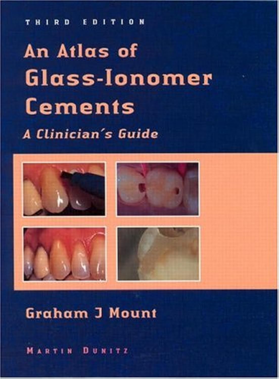 An Atlas of Glass-Ionomer Cements: A Clinician's Guide Medicine