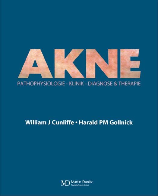 Acne: Diagnose Und Therapie Medicine