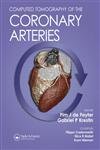 Computed Tomography Of The Coronary Arteries Medicine