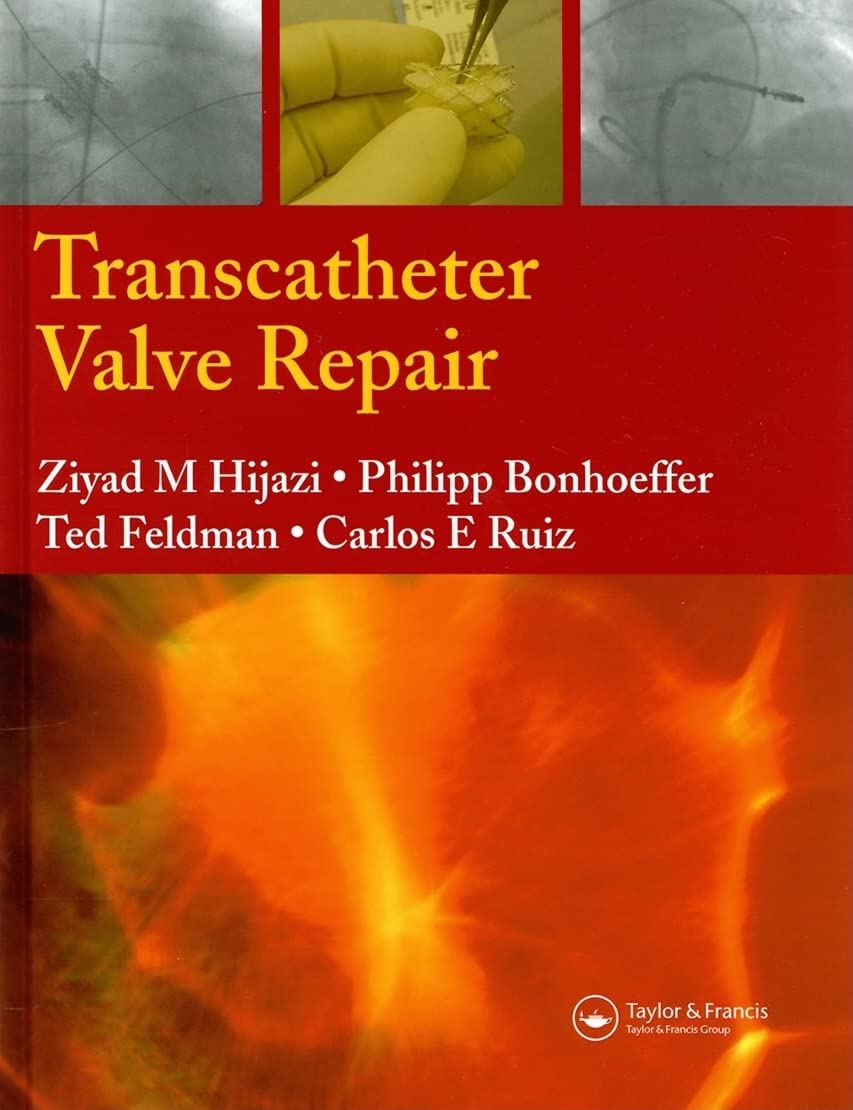Transcatheter Valve Repair Medicine