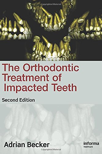 The Orthodontic Treatment of Impacted Teeth Medicine