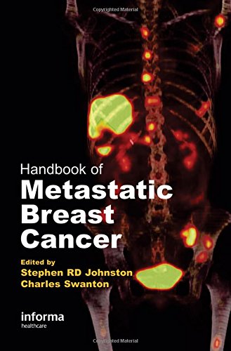 Handbook of Metastatic Breast Cancer Medicine