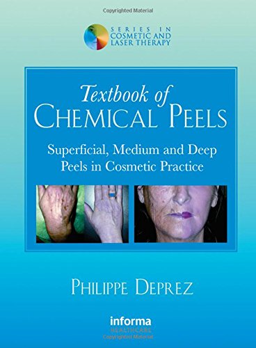 Textbook of Chemical Peels: Superficial, Medium and Deep Peels in Cosmetic Practice (Series in Cosmetic and Laser Therapy, Band 2) Medicine
