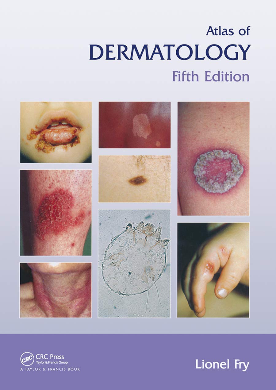 Atlas of Dermatology, Fifth Edition (Encyclopedia of Visual Medicine Series) Medicine
