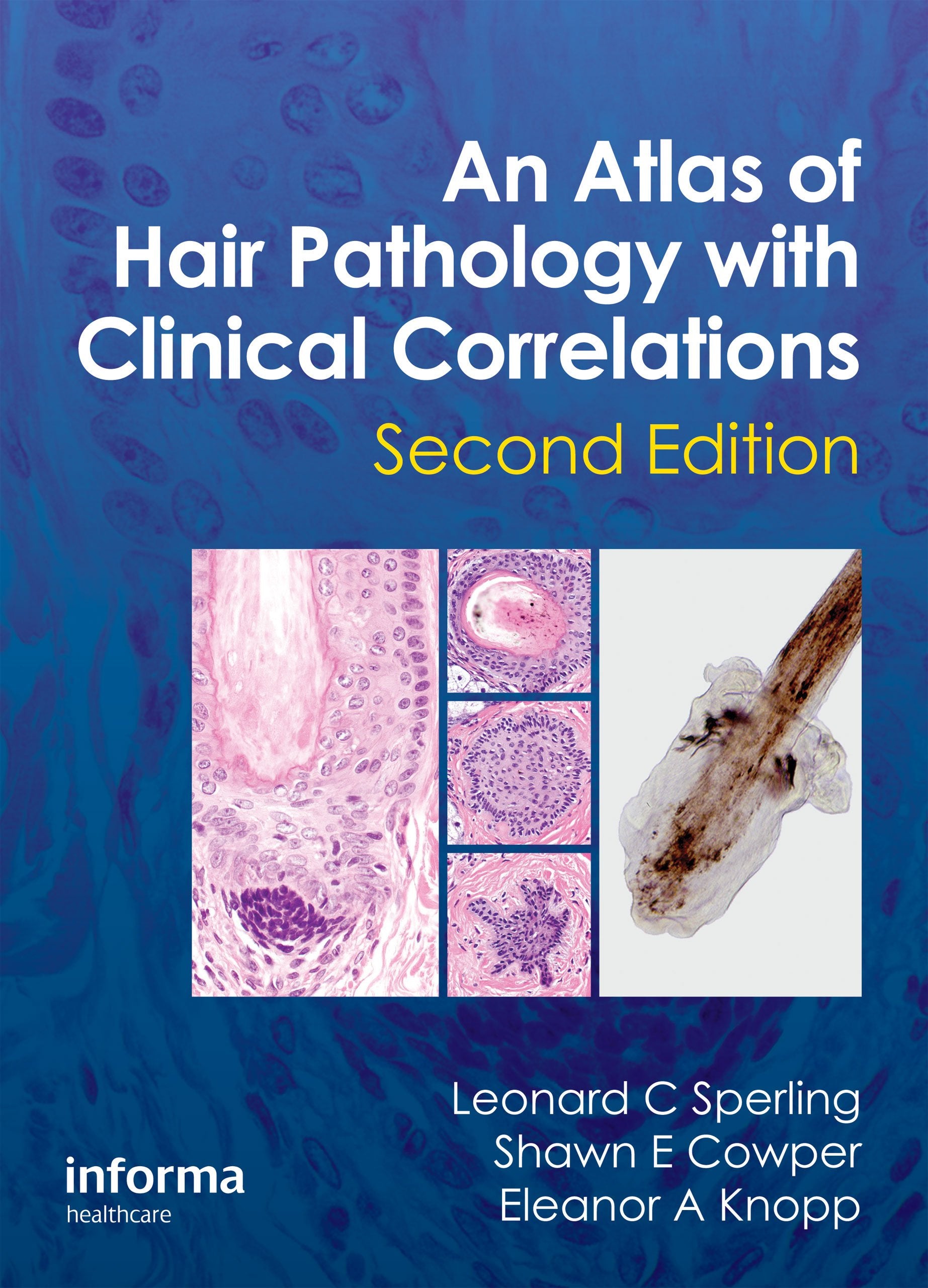 An Atlas of Hair Pathology with Clinical Correlations Medicine